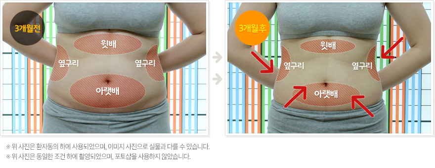 before-after